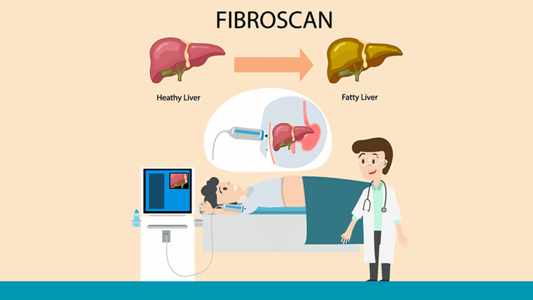 Understanding FibroScan